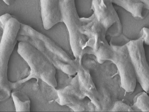 New material kills E. coli bacteria in 30 seconds