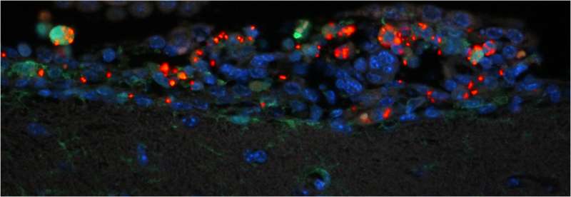NIH scientists develop new mouse model to study Salmonella meningitis