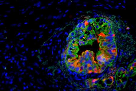 Novel imaging model helps reveal new therapeutic target for pancreatic cancer