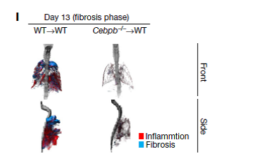 Oddly shaped immune cells cause fibrosis
