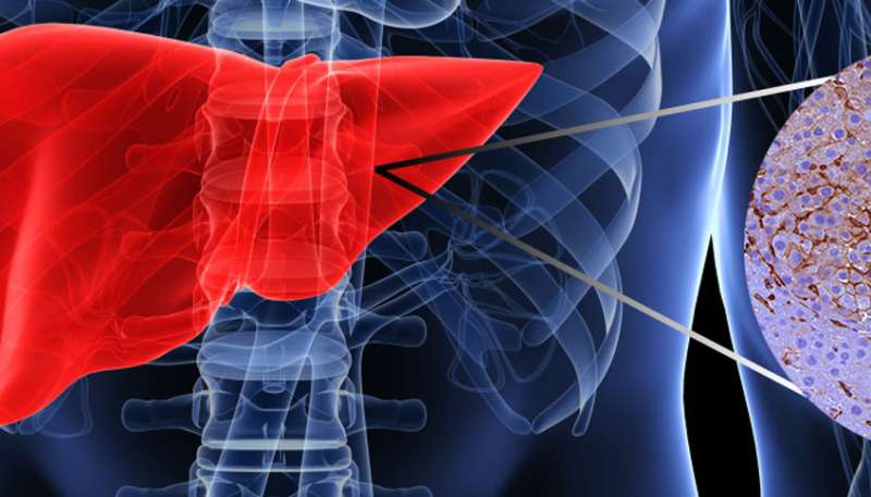 One more piece in the puzzle of liver cancer identified