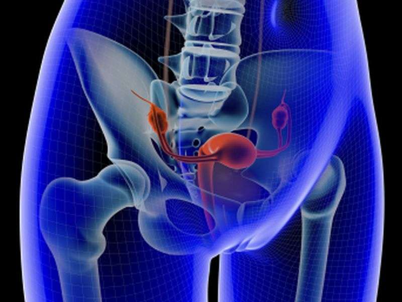Ovarian preservation doesn't impact prognosis in cervical CA