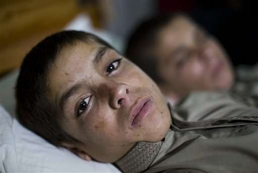 Pakistan treating 2 brothers who become paralyzed each night