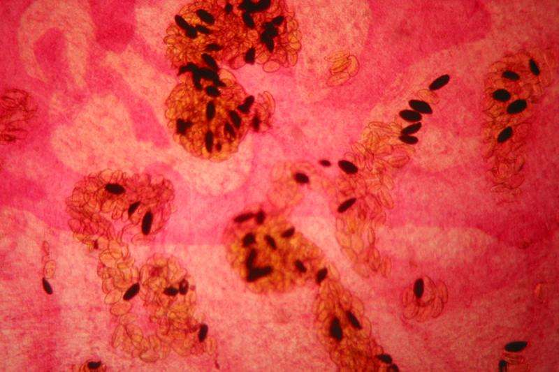 Parasites could hold the key to halting MS