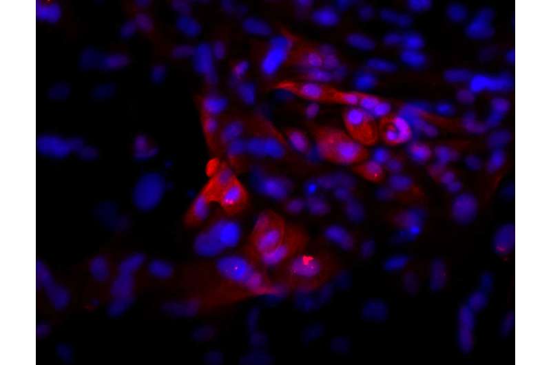 Pituitary tissue grown from human stem cells releases hormones in rats