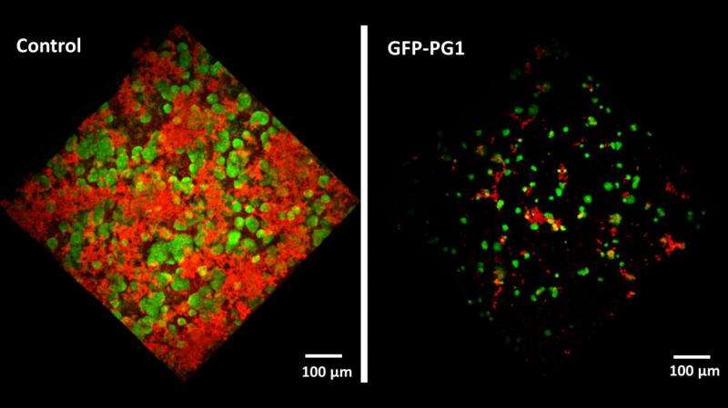 Plant-made antimicrobial peptide targets dental plaque and gum tissues