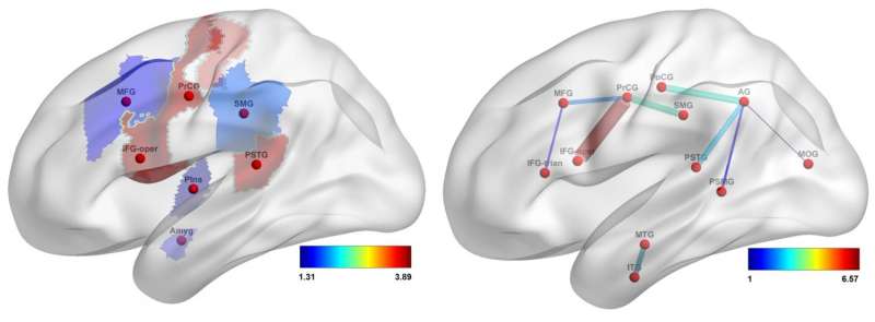 Predicting language deficits after stroke with connectome-based imaging