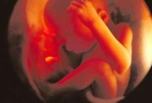 Preeclampsia in pregnancy linked to teenagers’ lack of motor skills