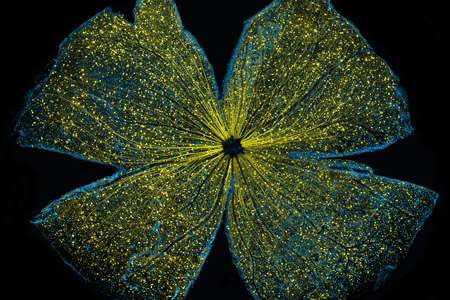 Promise of gene therapy for glaucoma shines bright in award-winning image