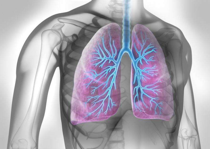 Protein biomarker as potential tool for predicting lung cancer survival