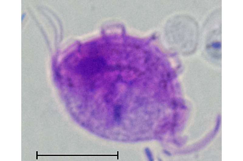 Protozoan parasite increases risk of colitis, study reveals