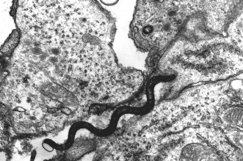 Re-emergence of syphilis traced to pandemic strain cluster