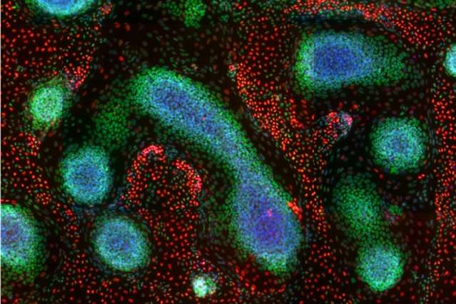 Researchers coax human stem cells to form complex tissues