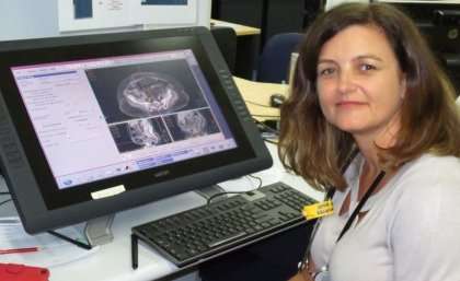 Research questions whole brain radiotherapy for older lung cancer patients