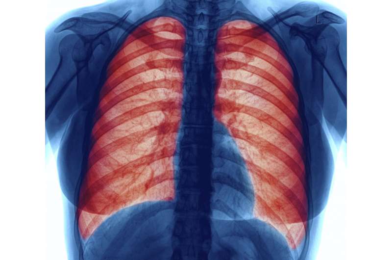 Risk of mortality linked to interstitial lung abnormalities