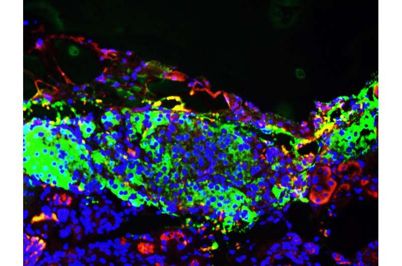 Salk scientists find 'secret sauce' for personalized, functional insulin-producing cells