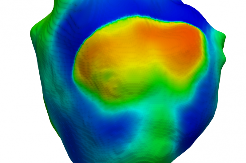 Scientists use 'virtual heart' to model heart failure