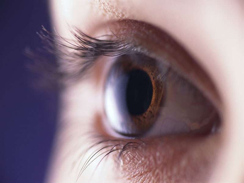 Severe symptoms, ocular pain linked to dry eye persistence