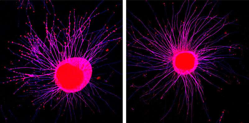 Signaling molecules can make neuronal extensions retract at a distance