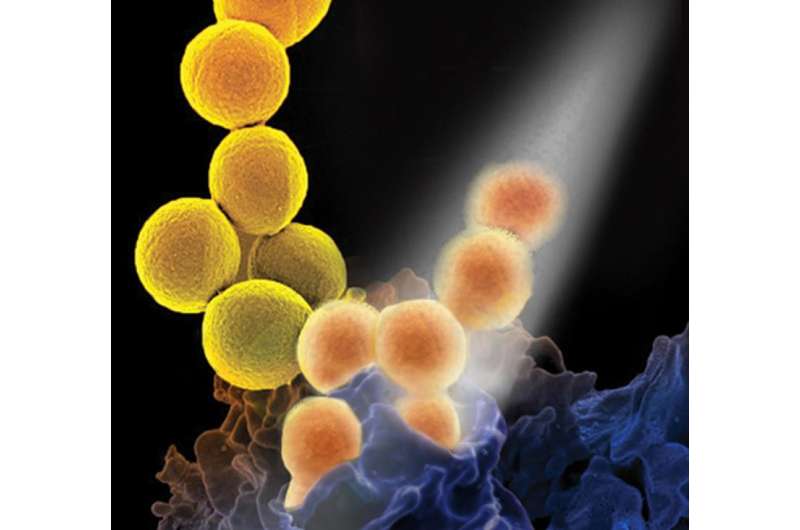 Simple changes to antibiotic treatment of MRSA may help beat the bacteria