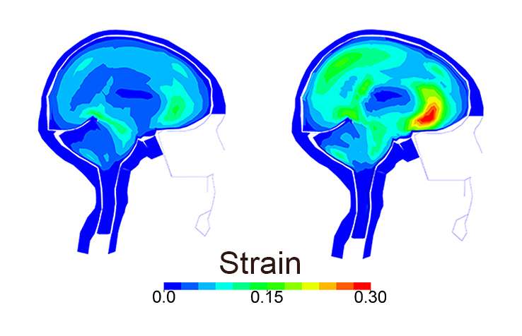 Simulations show how helmets would have protected bike crash victims' brains