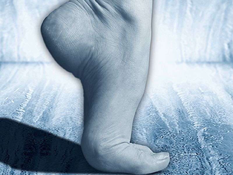 Soles of the feet should also be checked for skin cancer