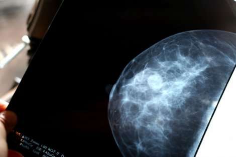 Some breast cancer patients with low genetic risk could skip chemotherapy, study finds