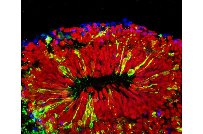 Sophisticated 'mini-brains' add to evidence of Zika's toll on fetal cortex