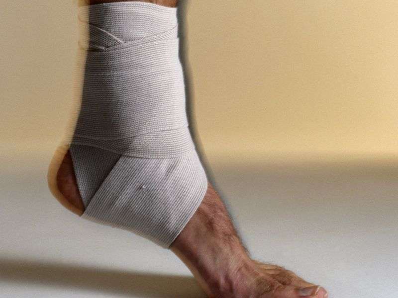 Sprained ankle could pose longer-term harms to health