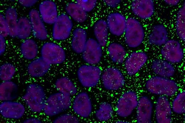 Standard method for deriving stem cells may be better for use in regenerative medicine