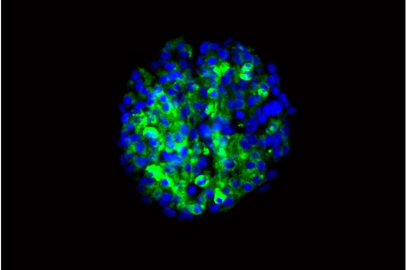Stem cells from diabetic patients coaxed to become insulin-secreting cells