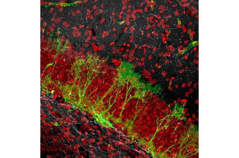 Stem cells in the granular region of the dentate gyrus of the hippocampus.