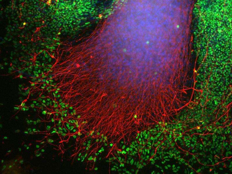 Stemming the flow: Stem cell study reveals how Parkinson's spreads