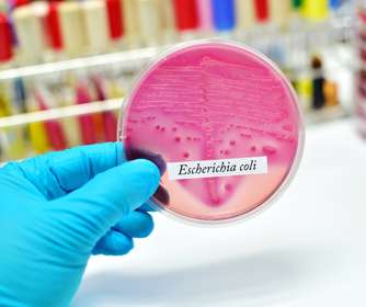 Study describes new strategies for investigating microbial outbreaks