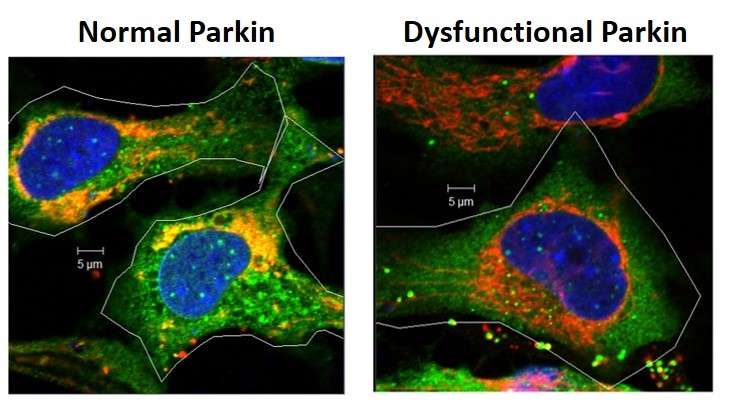 Study first to show role of Parkin gene in eye lens free radical formation, cell survival