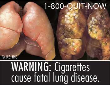 Study: Graphic pictures on cigarette packs would significantly reduce smoking death rate