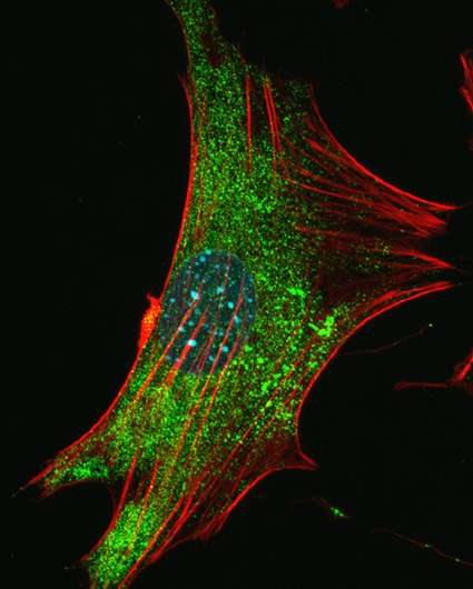 Study implicates glial cells in fragile X syndrome