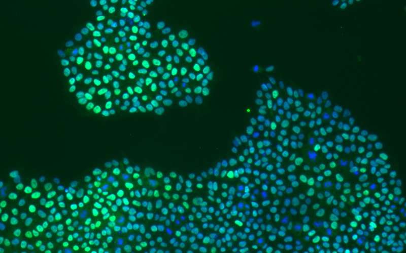 Study shows aging process increases DNA mutations in important type of stem cell