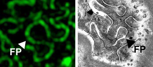 Super-resolution microscope promises faster, cheaper kidney disease diagnosis