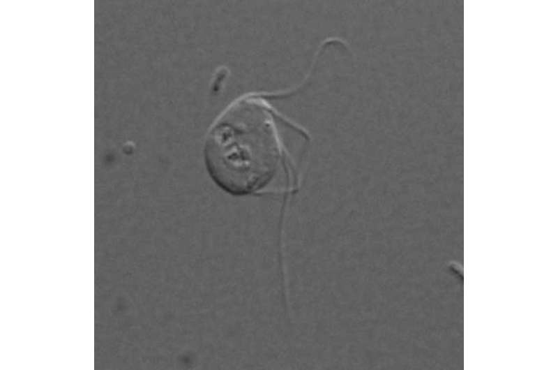 Surprise! This eukaryote completely lacks mitochondria