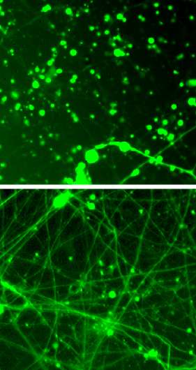 Tamping down neurons' energy use could treat neurodegeneration