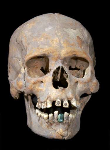 The 1,600-year-old skeleton of an upper-class woman found near Mexico's ancient Teotihuacan wore a prosthetic lower tooth made o