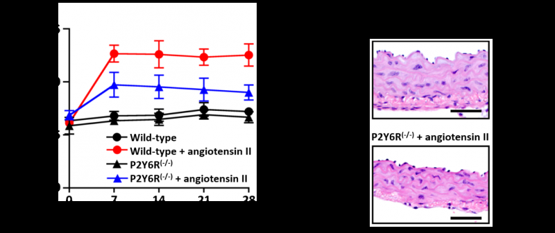 The age-related change of angiotensin receptor promotes hypertension