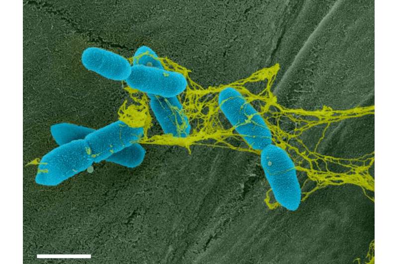 The arms race at the plant root: How soil bacteria fight to escape sticky root traps