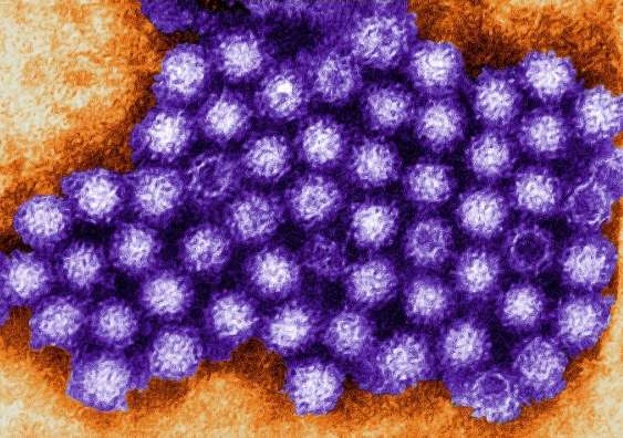 Three new noroviruses cause gastro outbreaks across Australia