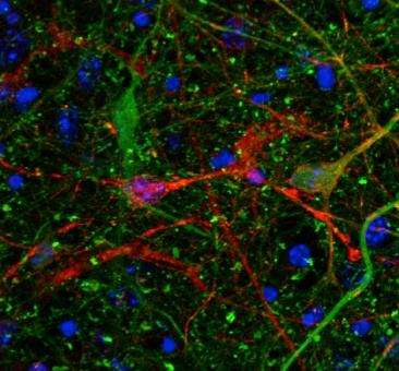 Toxic Alzheimer's protein spreads through brain via extracellular space