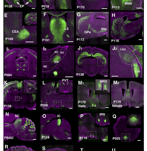 Trapping individual cell types in the mouse brain