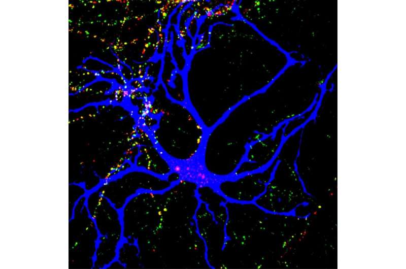 Trio of autism-linked molecules orchestrate neuron connections