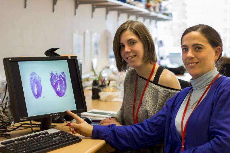 Two proteins control the growth of the heart and its adaptation to high blood pressure