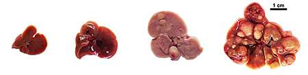 Unexpected activity of 2 enzymes helps explain why liver cancer drugs fail